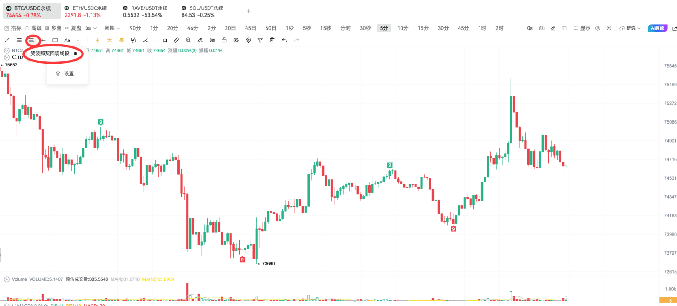 TD Indicator Practice | On-chain Bottom-fishing and Top-exiting Techniques_aicoin_figure16
